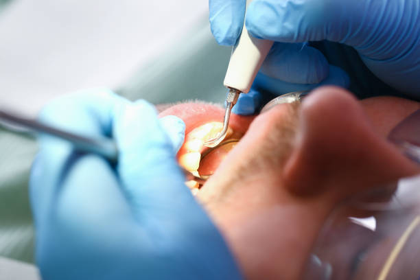 Best Emergency Treatment for Toothache in Broxton, GA