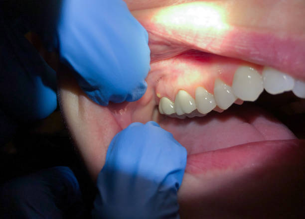 Best Emergency Dental Surgery in Broxton, GA
