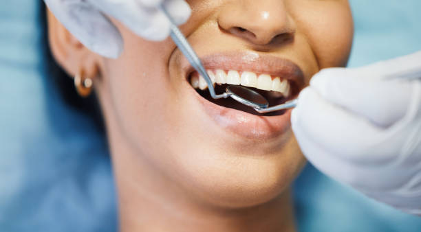 Best Emergency Root Canal Treatment in Broxton, GA