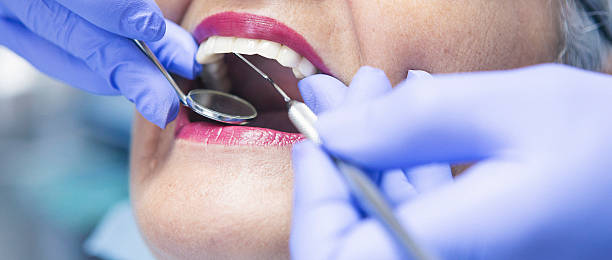 Best Emergency Treatment for Toothache in Broxton, GA
