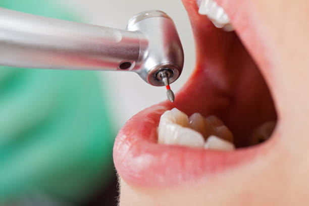 Best Emergency Broken Tooth Repair in Broxton, GA